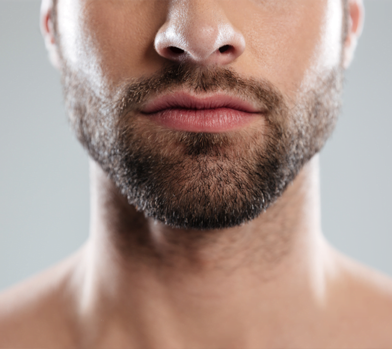 Step-by-Step Guide to the Beard Transplant Process