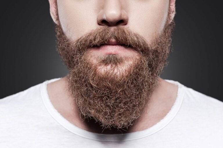 Beard Transplant in Marmaris